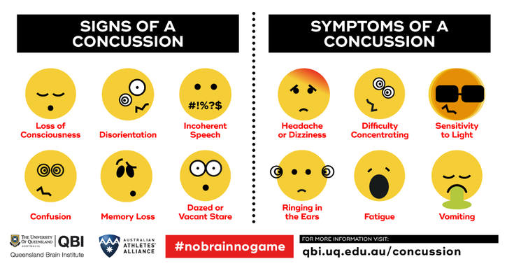 A diagram showing signs and symptoms of concussions.